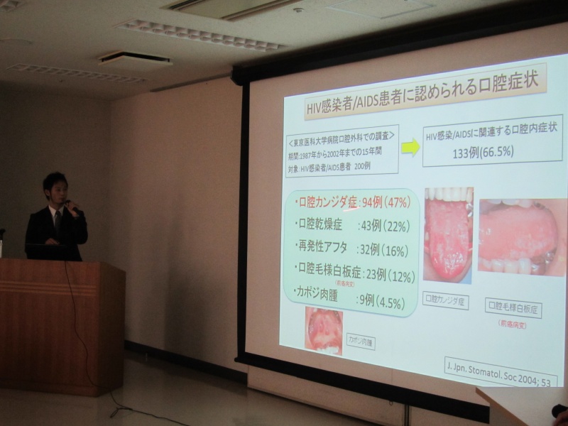 「HIV感染症と口腔内病変について」　HIV診療チーム・歯科医師