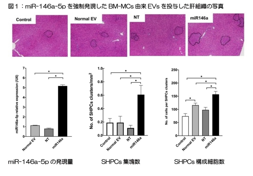 図1:miR-146a-5pを強制発現したBM-MCs由来EVsを投与した肝組織の写真