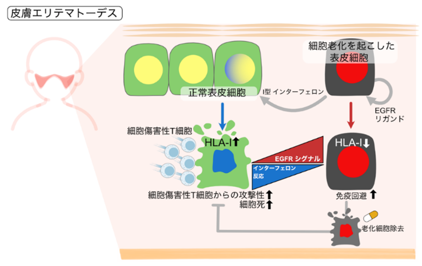 老化細胞はI型インターフェロンを産生して、正常細胞の　HLA-Iの発現を高め、細胞傷害性T細胞の攻撃性を高める。